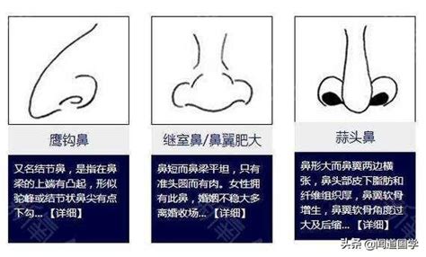 繼室鼻|鼻子面相圖解 (二) 鼻形 